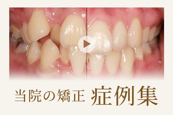 当院の矯正症例集